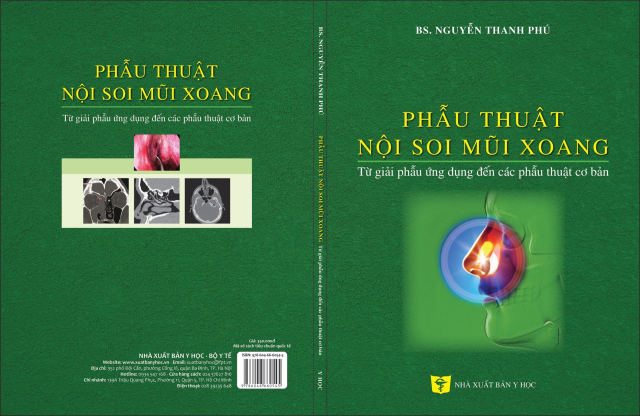 Phẫu thuật nội soi mũi xoang